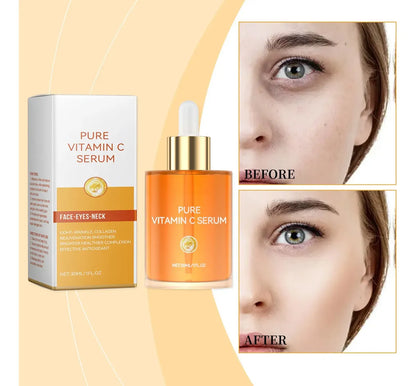 Sérum de Vitamina C Pura OUHOE (30ml) ROSTRO-OJOS-CUELLO 30ML. OUHOE