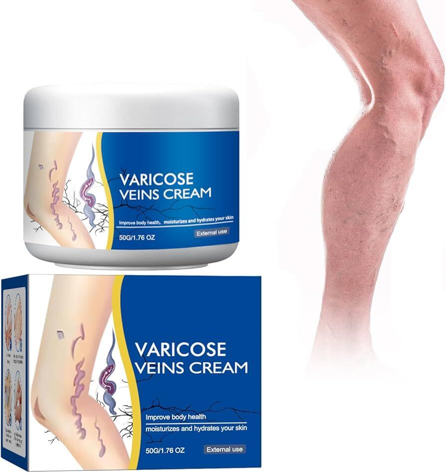 Crema para Piernas con Varices – Cuidado Hidratante y Efecto Confort para la Piel 🦵