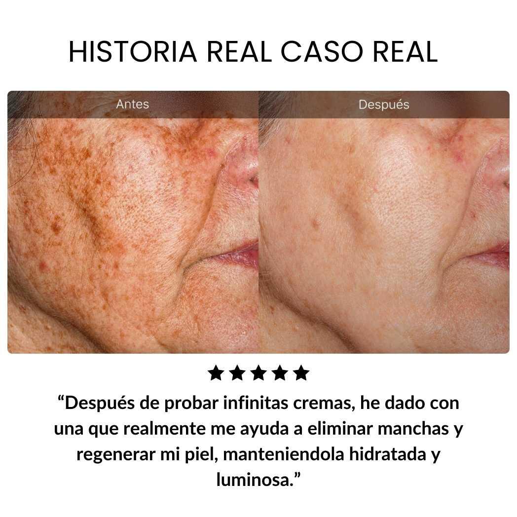 Sangre de Dragon Retinol Crema Antiedad - SADOER
