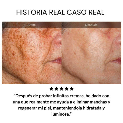Sangre de Dragon Retinol Crema Antiedad - SADOER