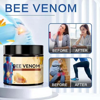 Crema con veneno de abeja para aliviar articulaciones y huesos