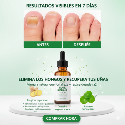 Spray Antihongos para Uñas 30ml