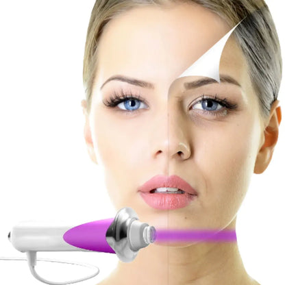 Beauty Stick Pro – Dispositiu Antienvelliment de Microcorrent