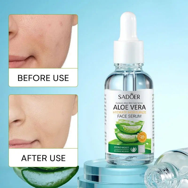 Esencia Facial Calmante e Hidratante 100% Natural con Aloe Vera – Hidratación y Regeneración Profunda