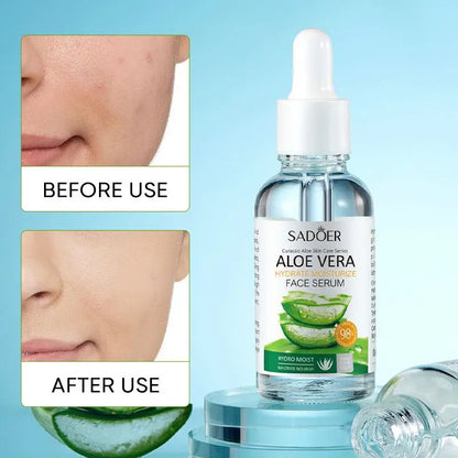 Esencia Facial Calmante e Hidratante 100% Natural con Aloe Vera – Hidratación y Regeneración Profunda