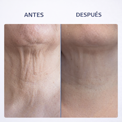 MASSATGEJADOR/Antiarrugues Corró 3D Integrat - Específic per a coll i rostre \ JAYSUING
