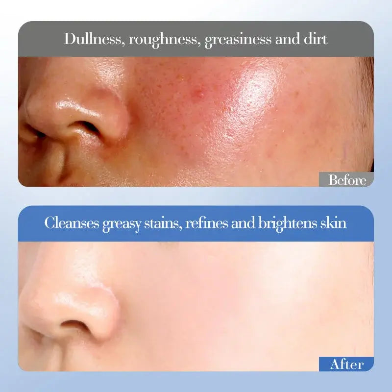 Crema Facial Hidratant Profunda – Il·luminadora amb Niacinamida i Arròs (50g)