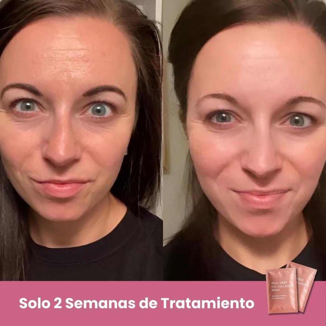 Máscaras de Biocolagénio - INCLUI 5 Máscaras