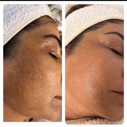 Crema Skin-care Coreana 2% Niacinamida Àcid Hialurònic (tipus Medicube)