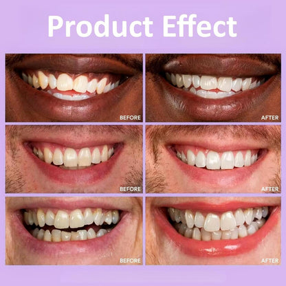 Tiras Blanqueadoras para Dientes – Sonrisa Más Blanca en Solo Días