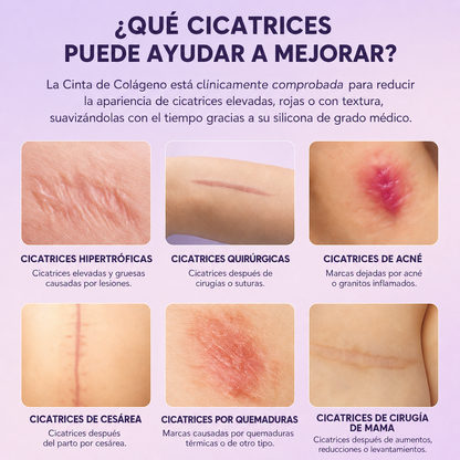 Tiras cicatrizantes