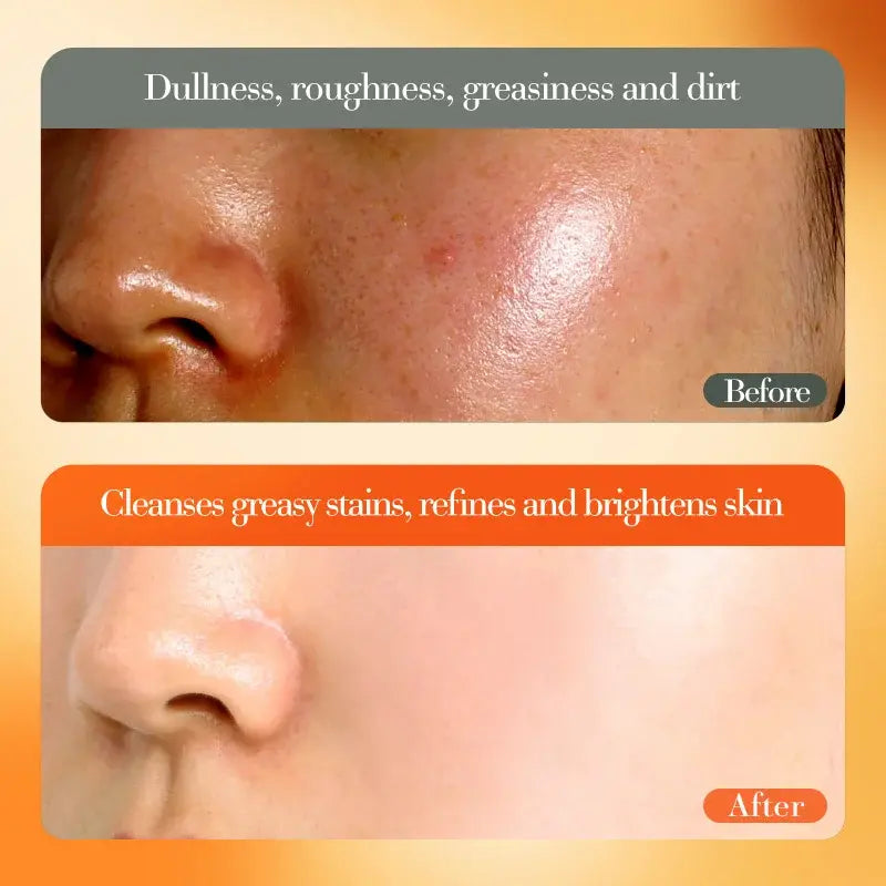 Crema Facial Blanquejadora i Il·luminadora amb Vitamina C (50g)