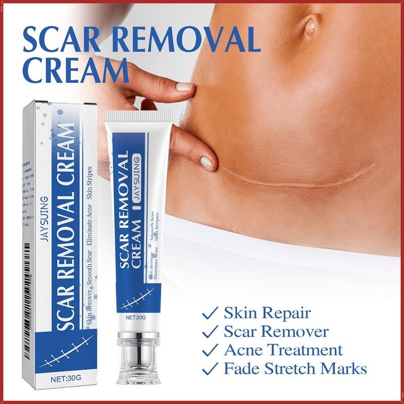 Crema para Eliminar Cicatrices 30GR JAYSUING – Regeneración y Mejora Visible de la Piel