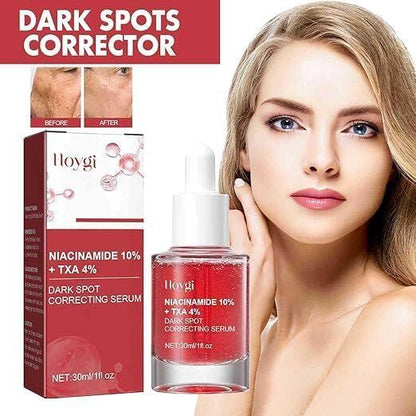 HOYGI Niacinamide Serum - Hidratació, Antimanses i Lluminositat per a Tot Tipus de Pell