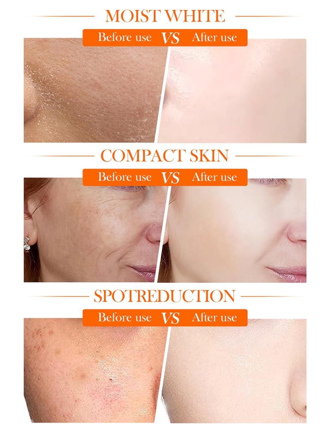 Crema Facial Blanqueadora Iluminadora 5 en 1 con Vitamina C Activa + Niacinamida – Piel Radiante en Cada Aplicación