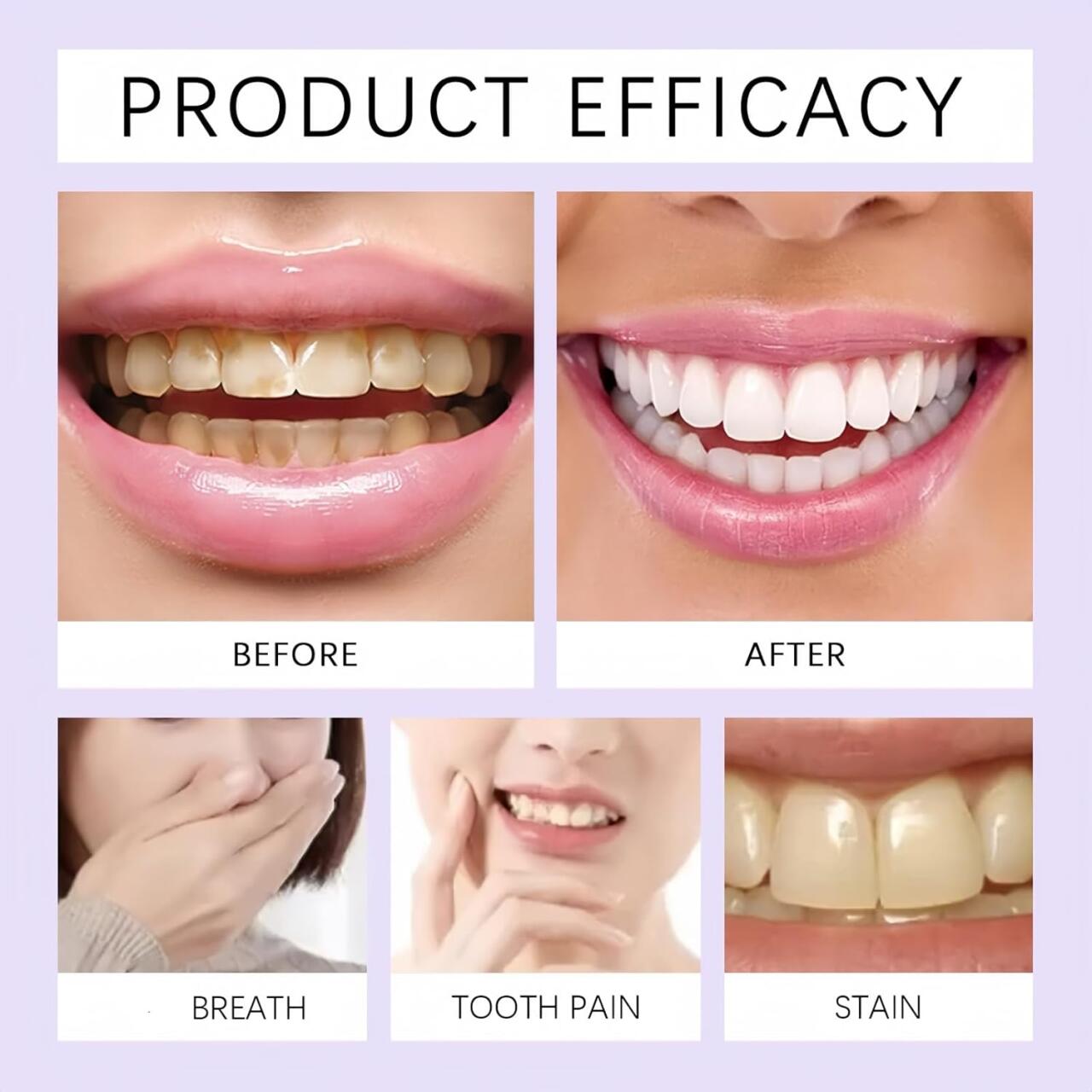 Tiras Blanqueadoras para Dientes – Sonrisa Más Blanca en Solo Días